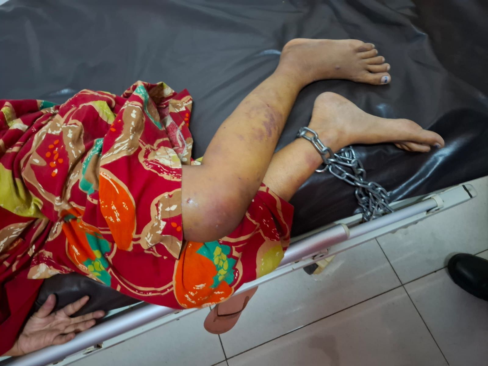 Suami Tega Aniaya Istri dan Disekap Dengan Kaki Dirantai, Gara-Gara Biaya Sekolah