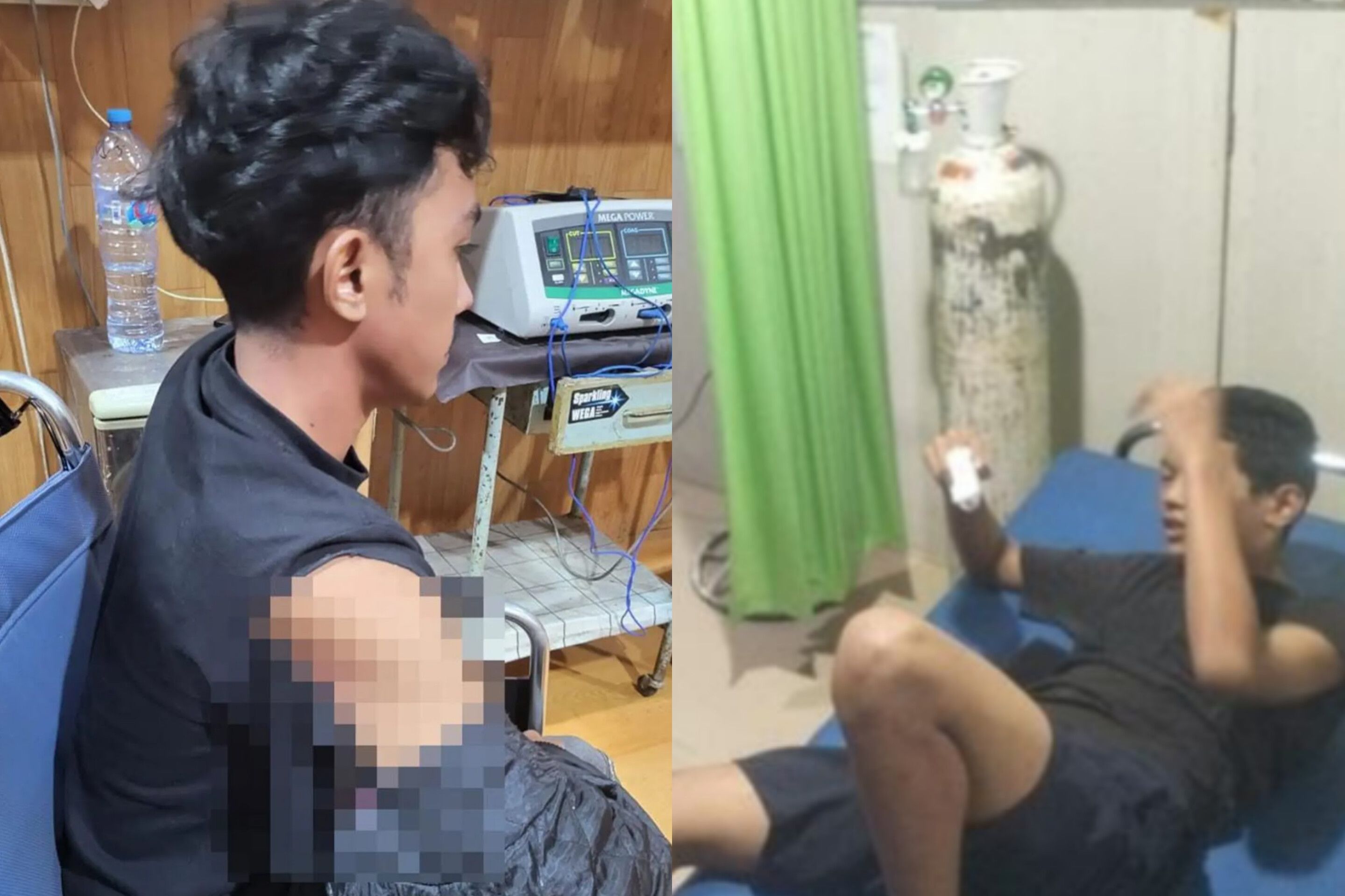 Teror Geng Motor Kembali Resahkan Warga di Makassar, 5 Orang Jadi Korban Busur Panah dan Tebasan Parang