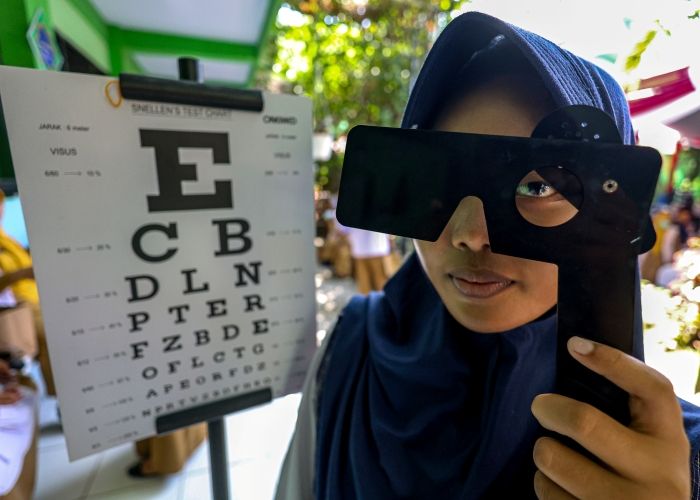 Waspada Retinoblastoma, Kanker Mata pada Anak yang Umum Terjadi