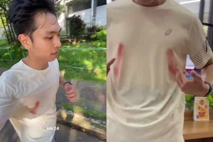 Viral Puting Pria Ini Berdarah saat Lari Jarak Jauh, Ternyata Ini Penyebabnya!