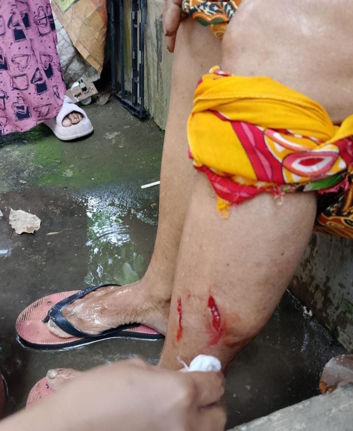 Serangan Monyet Liar, 6 Orang Warga Terluka Dari Usia Anak-Anak, Ustaz, dan Lansia