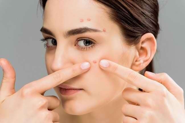 Beauty Hack Viral yang Ternyata Gak Aman, Waspadai Ini