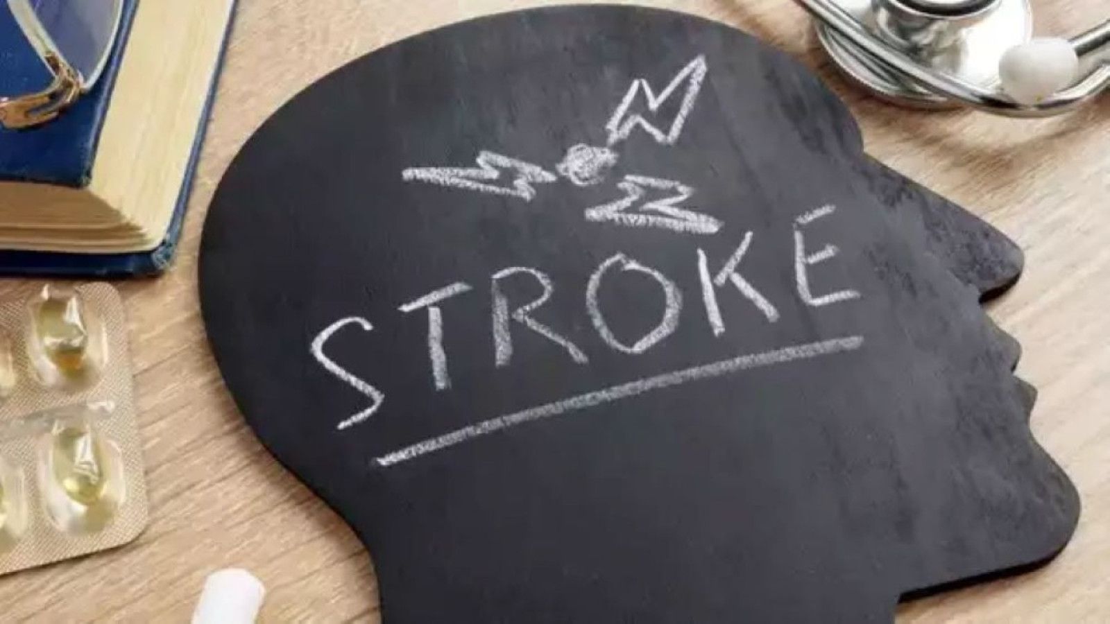 Mencegah Stroke: Pola Hidup Sehat Sebagai Kunci Utama