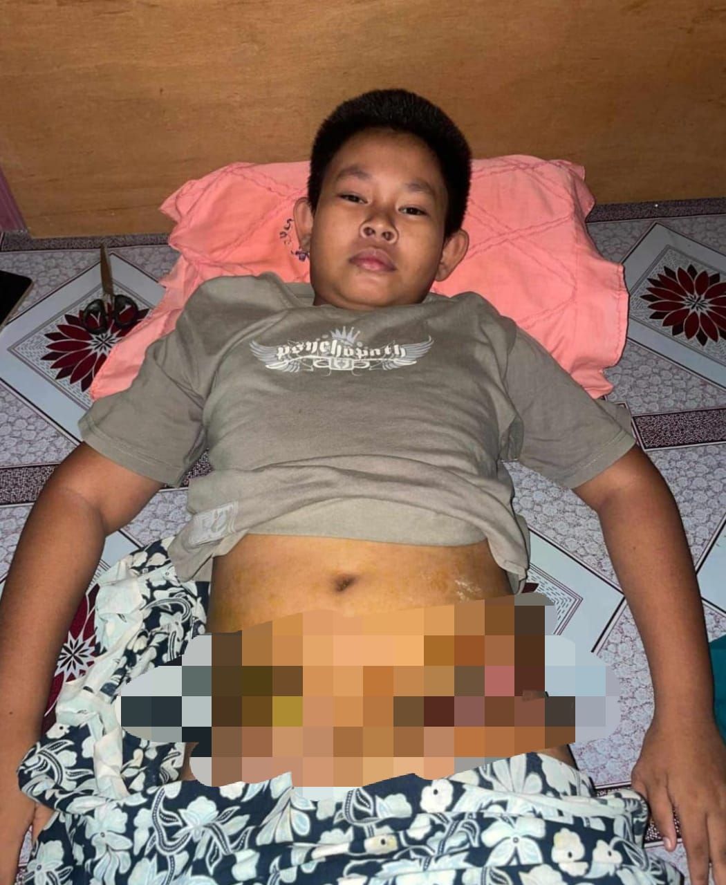 Yuk Bantu Ahkimie, Bocah dari Nunukan yang Kini Melawan Kanker