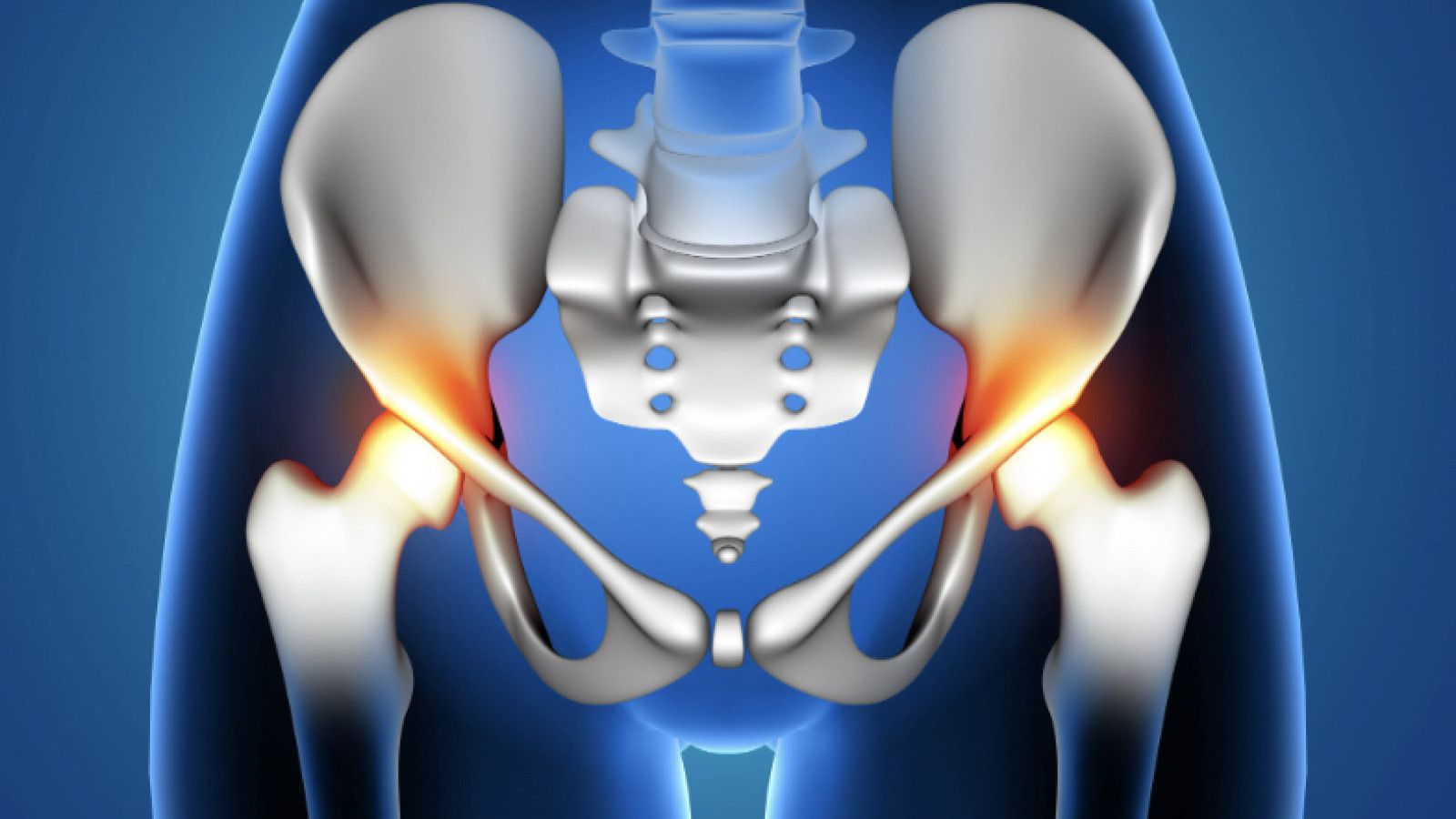 Memahami Hernia Nukleus Pulposus: Gejala, Penyebab, dan Pengobatan