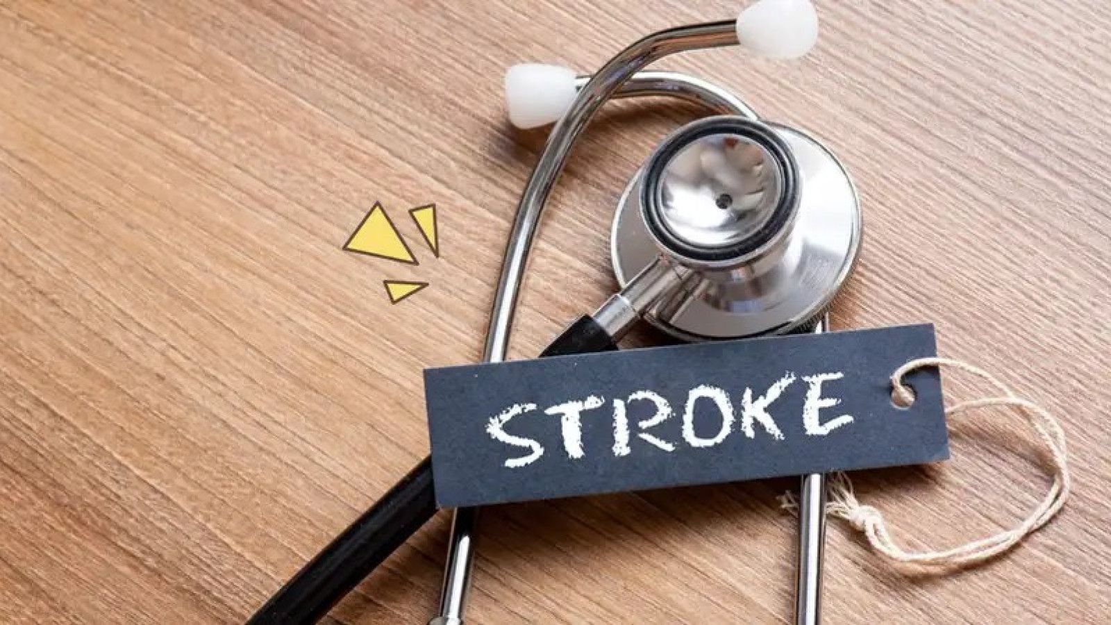 Waktu Emas: Pentingnya Penanganan Segera untuk Serangan Stroke