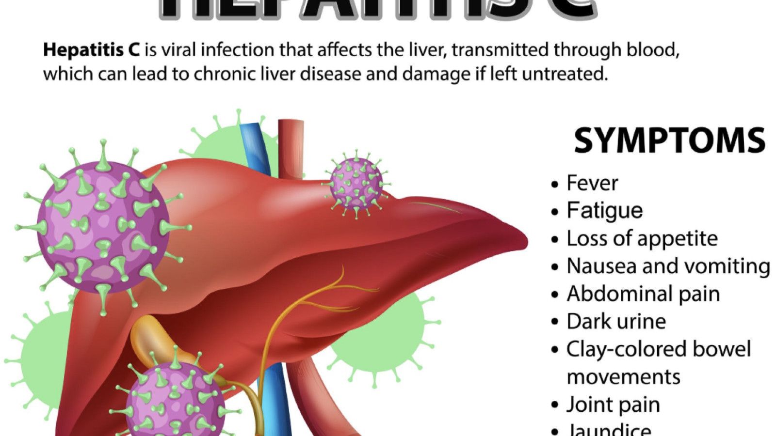 Mengetahui Hepatitis C: Ancaman Serius bagi Kesehatan Hati