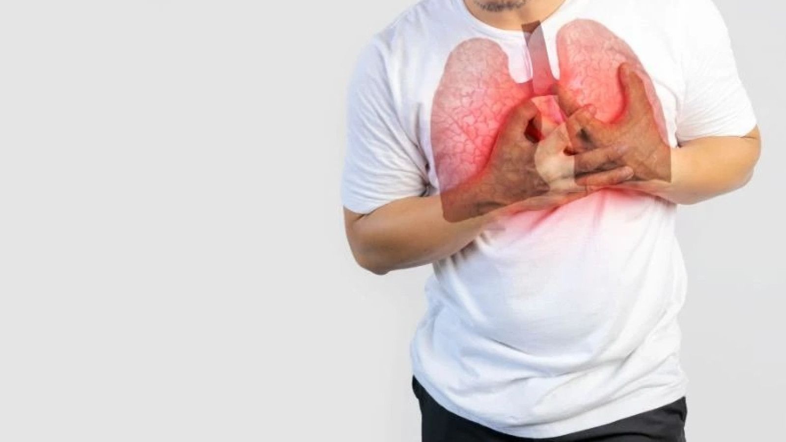 Hampir 83 Persen Penderita Tuberkulosis Tanpa Batuk Persisten: Temuan Mengejutkan dari Penelitian Terbaru