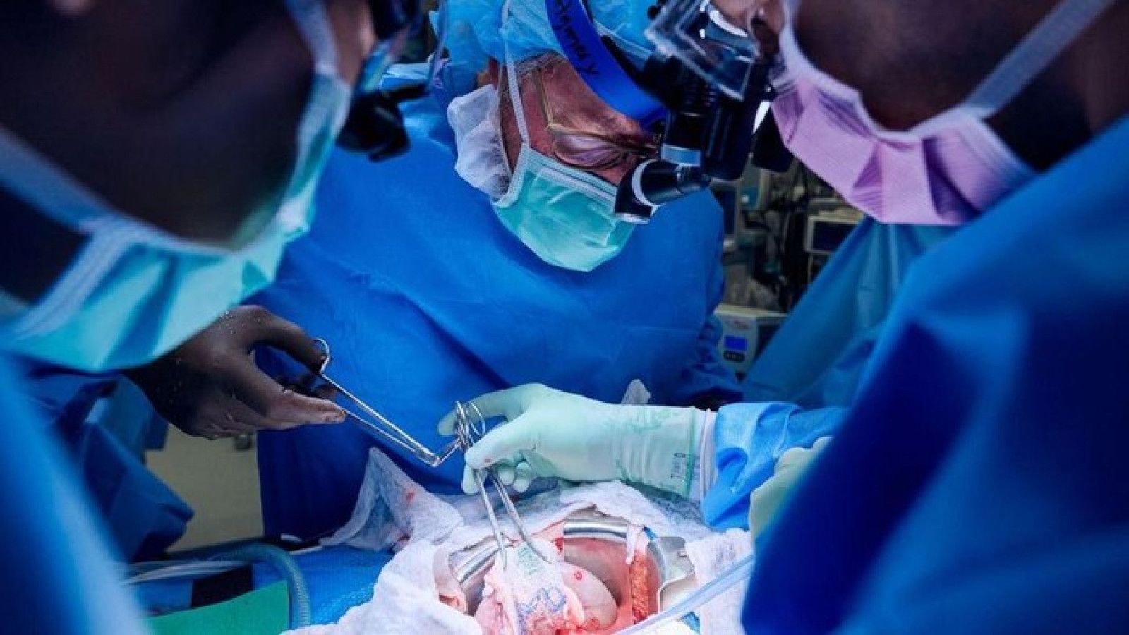 Xenotransplantasi: Harapan Baru dalam Transplantasi Organ