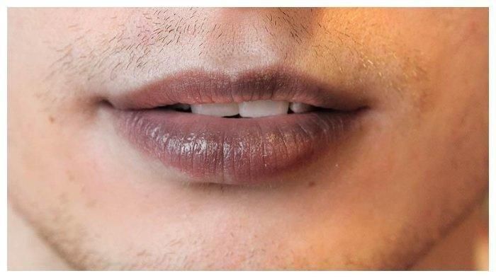 7 Bahan Alami untuk Hilangkan Bibir Hitam, Wajib Tau!