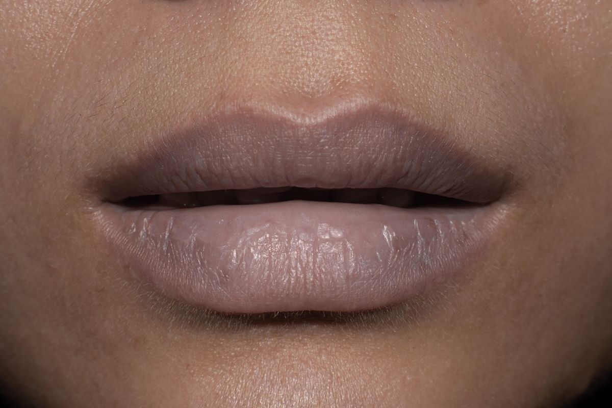 7 Bahan Alami untuk Hilangkan Bibir Hitam, Wajib Tau!