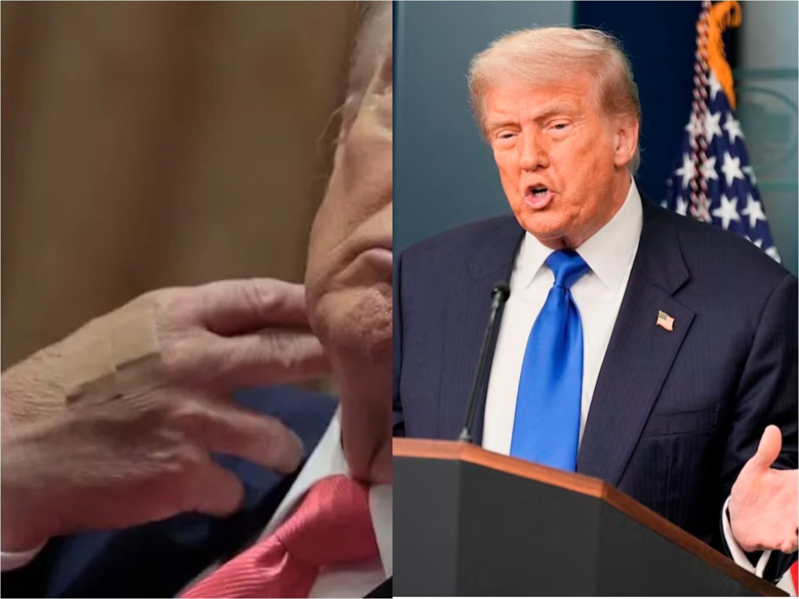 Plester di Tangan Trump Jadi Sorotan, Ini Penjelasan Gedung Putih
