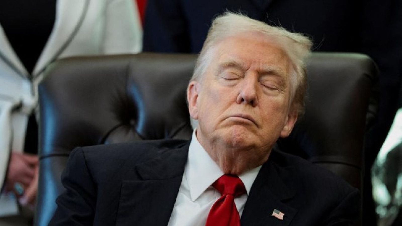 Donald Trump Klarifikasi Kondisi Kesehatan dan Memar di Tangan