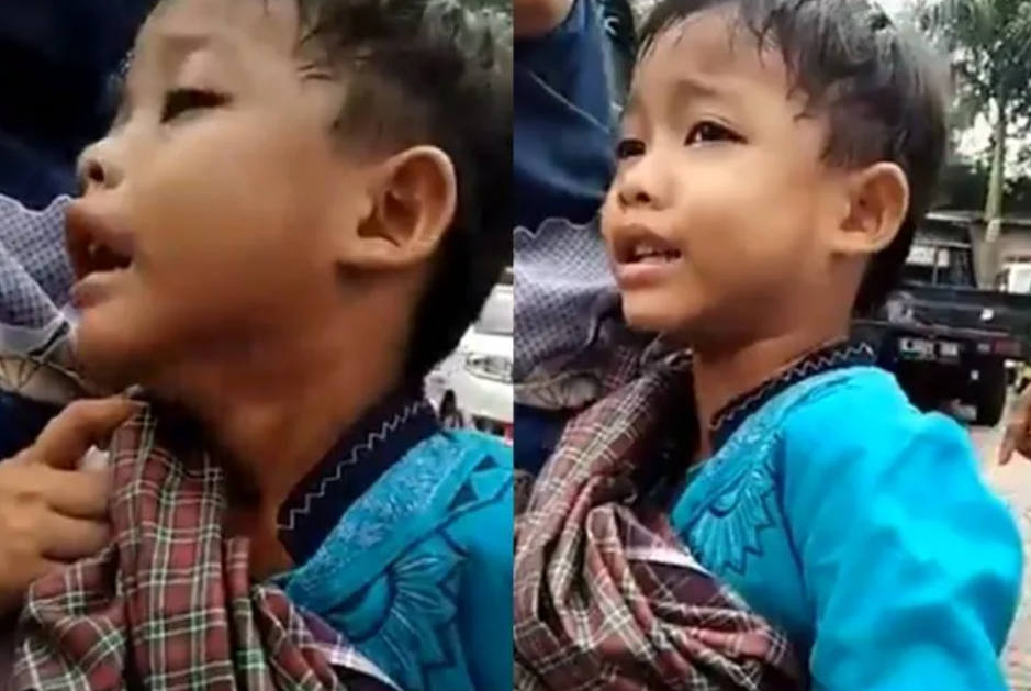 Kaget dengan Bentuknya Usai Disunat, Reaksi Bocah Ini Bikin Ngakak