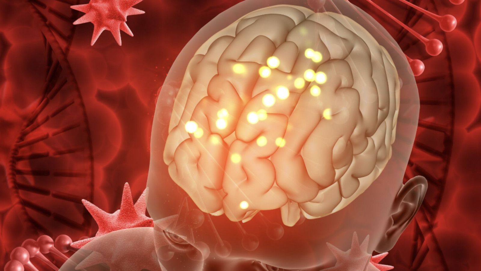 Memahami Multiple Sclerosis: Penyakit Autoimun yang Memengaruhi Sistem Saraf