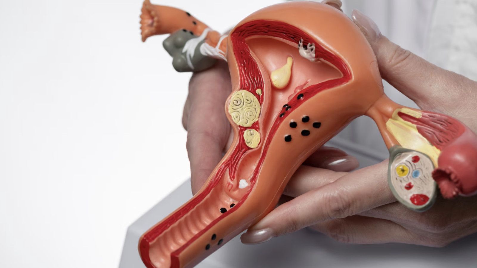 Vaksin HPV: Perlindungan Optimal Melawan Kanker Serviks