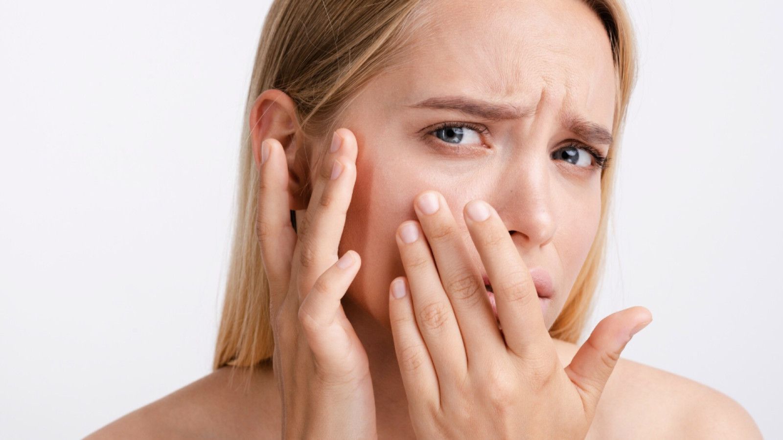 Cara Efektif Mengatasi Bekas Jerawat Merah dengan Serum