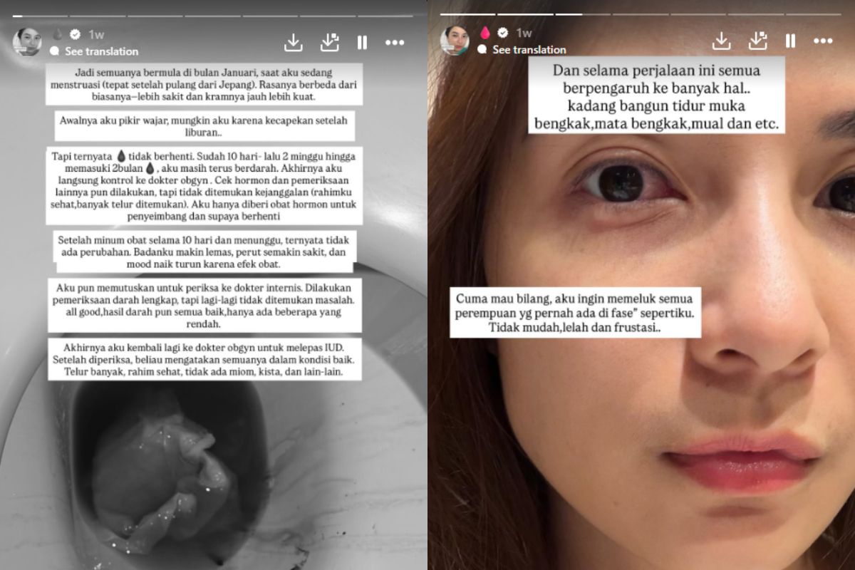Alami Pendarahan hingga Jalani Empat Prosedur Operasi Sekaligus, Chelsea Olivia Sakit Apa?