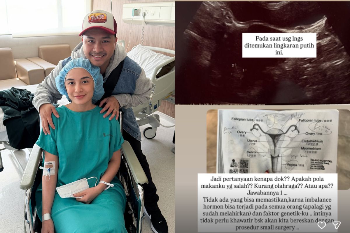 Alami Pendarahan hingga Jalani Empat Prosedur Operasi Sekaligus, Chelsea Olivia Sakit Apa?