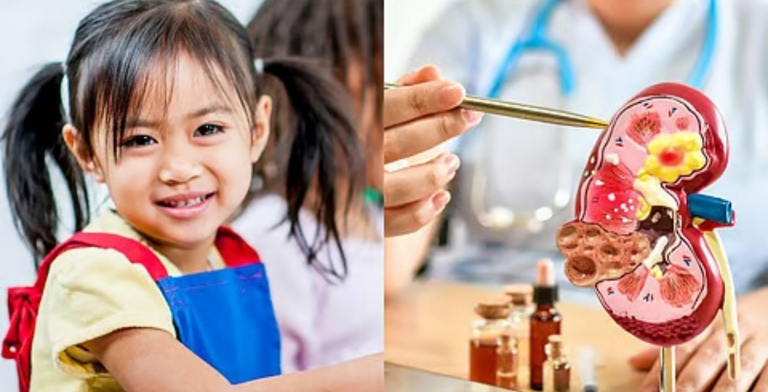 Peluang Sembuh Kanker Ginjal pada Anak Bisa Capai 90 Persen, Ini Caranya!