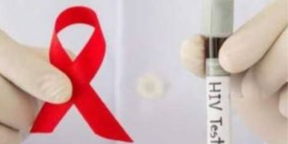 Pekanbaru Tertinggi, Kasus AIDS di Riau Mayoritas Usia 25–49 Tahun