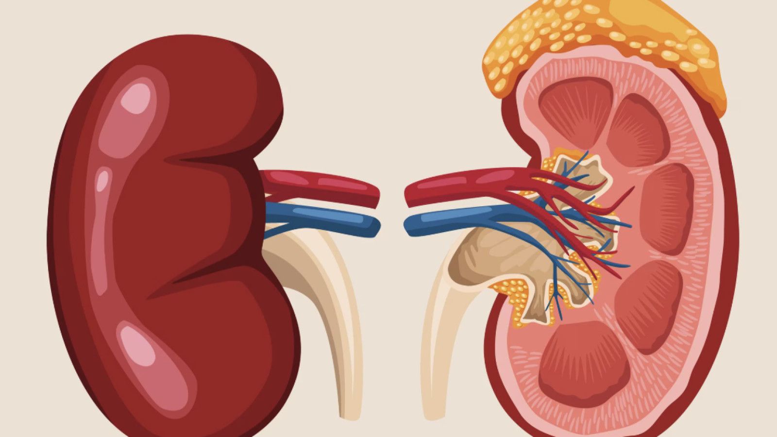 Mengenal Penyakit Ginjal Kronis dan Pentingnya Pemeriksaan Rutin
