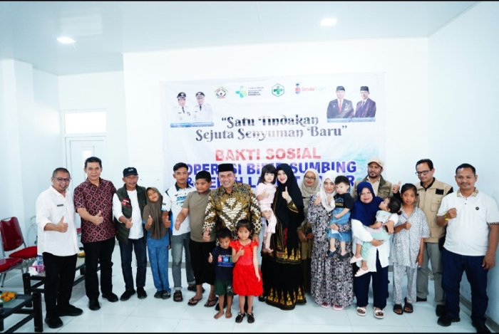 Wabup Aceh Tengah Buka Operasi Bibir Sumbing Gratis di RSUD Datu Beru