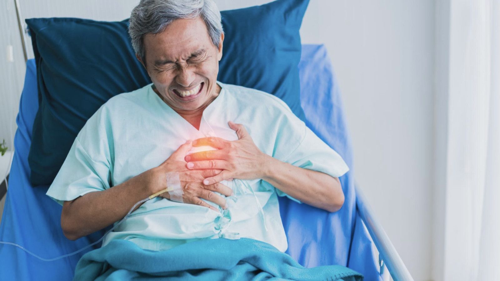 Memahami Stroke Hemoragik: Ancaman Serius bagi Kesehatan Otak