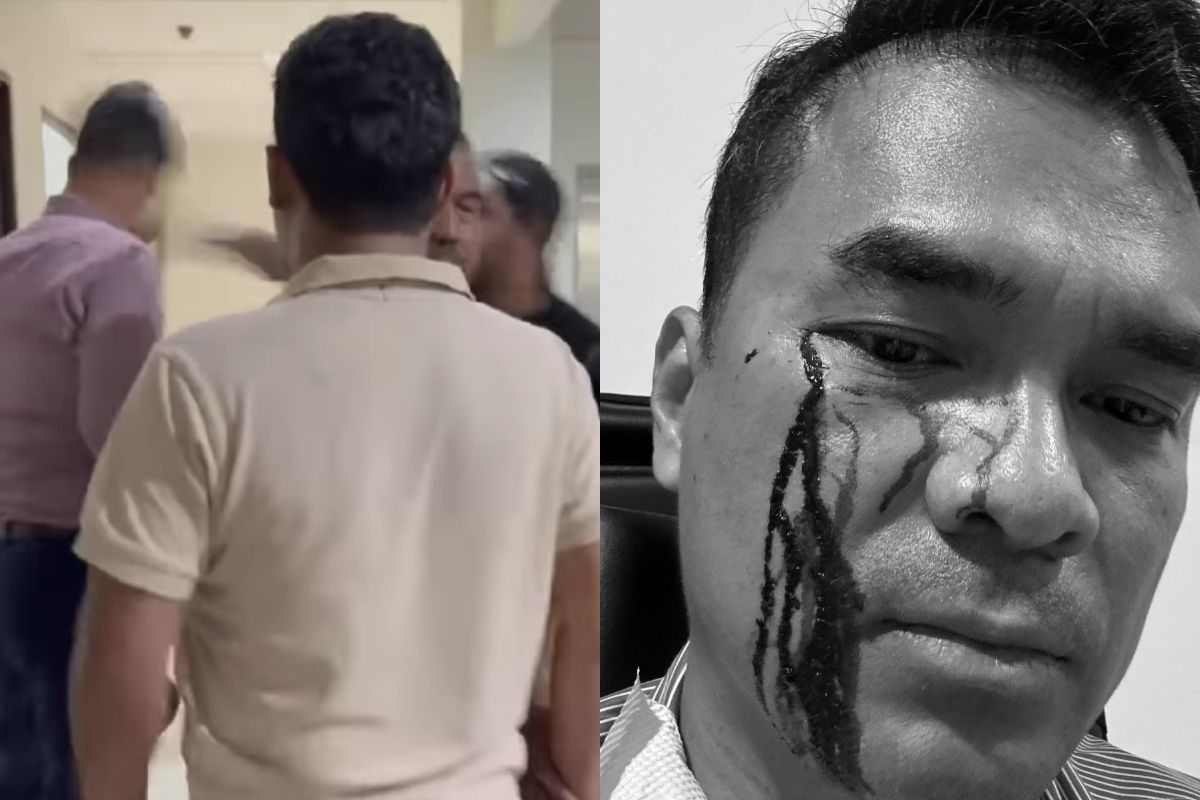 Viral Waketum PSI Jadi Sasaran Pemukulan, Wajah Bersimbah Darah!