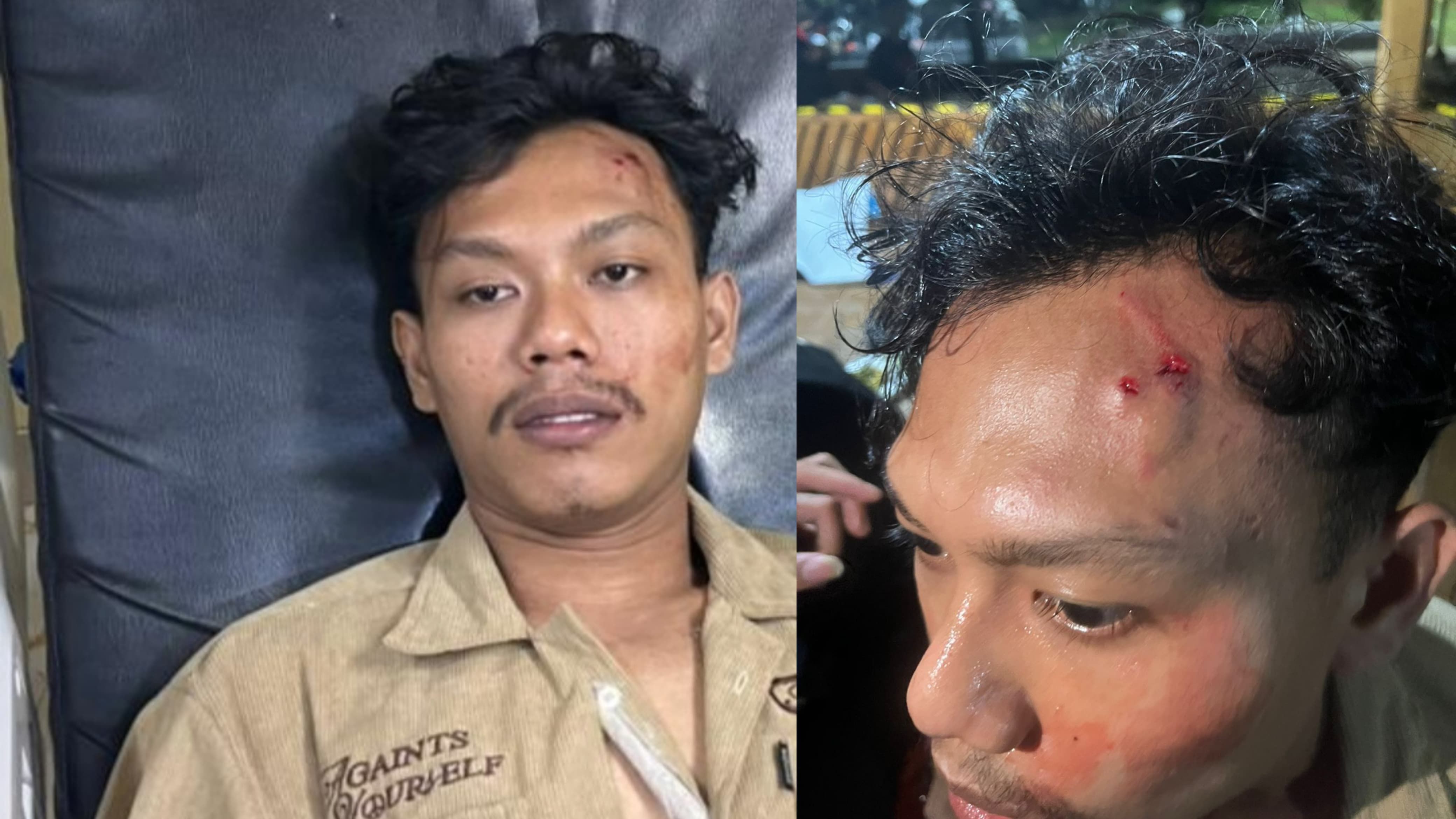 Menjadi Korban Pengeroyokan di Lingkungan Kampus UNIBA, Mahasiswa Tempuh Jalur Hukum