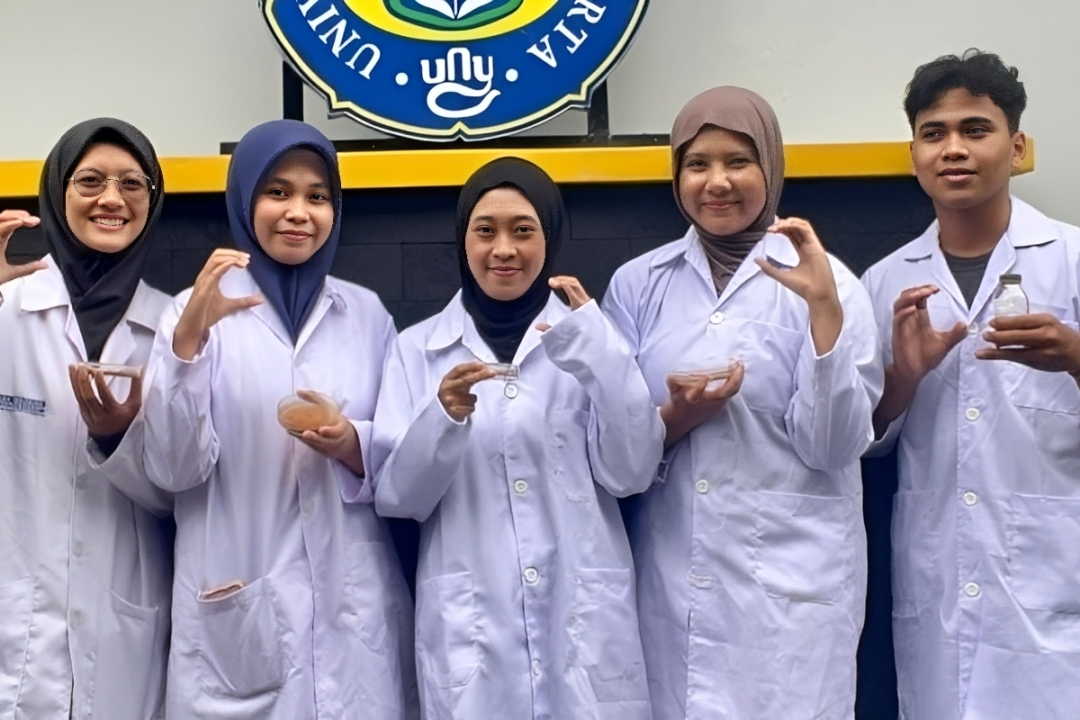 Inovasi Keren Mahasiswa UNY! Gel dari Cangkang Keong Bantu Cegah Gigi Berlubang
