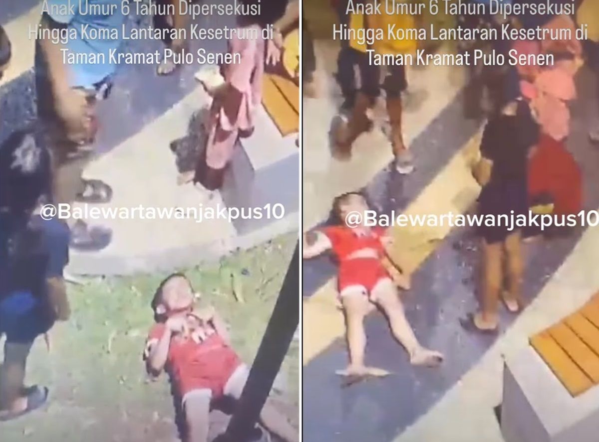 Viral Bocah 6 Tahun Jadi Korban Bully hingga Koma karena Kesetrum di Jakpus, Polisi Turun Tangan