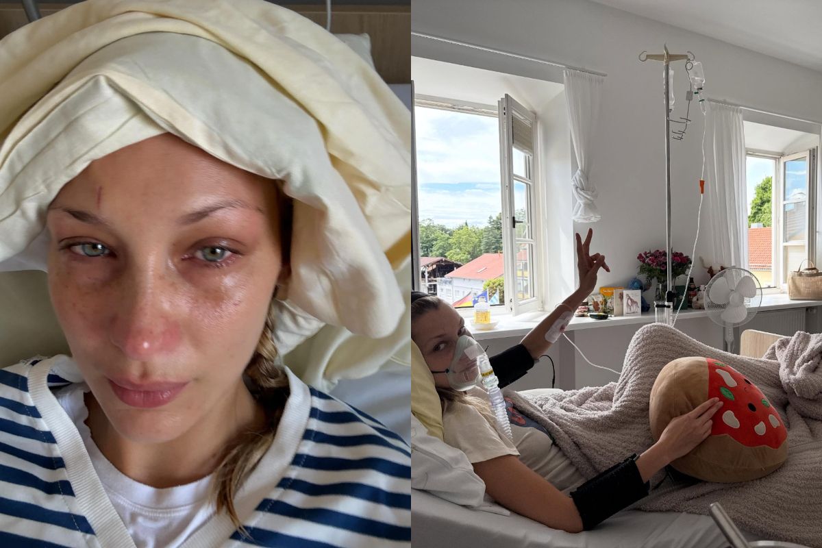 Bella Hadid Cerita Sulitnya Hidup dengan Penyakit Kronis: Bangun Tidur Pun Udah Cemas