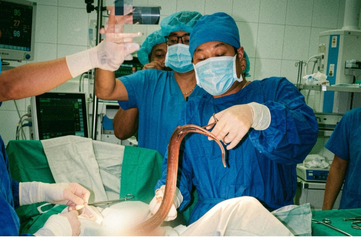 Percaya Mitos, Pria Masukkan Belut ke Anus Demi Atasi Sembelit hingga Nyaris Tewas