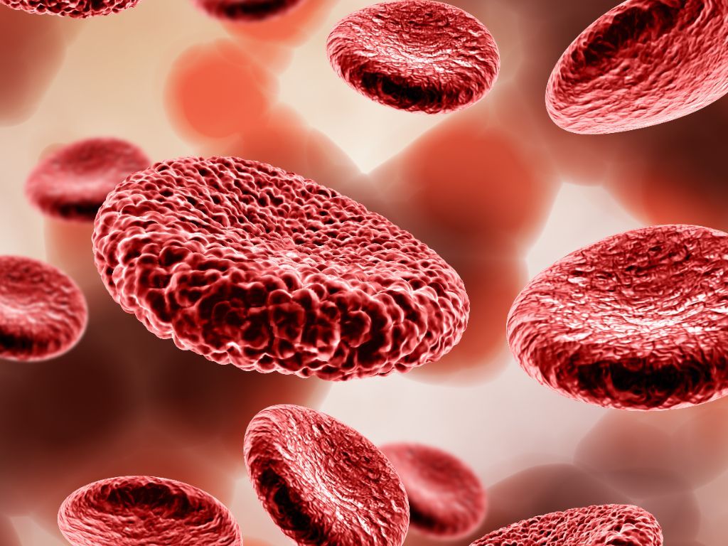 Awas! Gejala Leukemia Mieloid Akut Mirip Flu, Tapi Bisa Berakibat Fatal