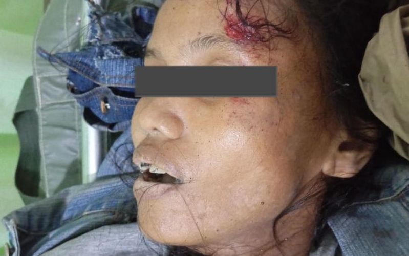 Pejalan Kaki Tewas Tertabrak TransJogja di Simpang Tiga Adisucipto, Polisi Amankan Pengemudi