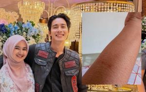 Selebgram Pidie Diduga Jadi Korban KDRT, Suami Sampaikan Permintaan Maaf dan Klarifikasi