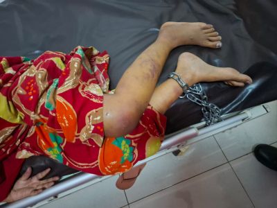 Kasus Istri Dianiaya dan Dirantai, Korban Dapat Pendampingan Sosial dan Pulang ke Banyuwangi
