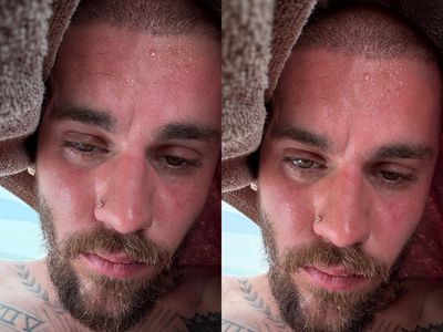 Justin Bieber Bikin Geger Lagi, Unggah Foto Aneh yang Bikin Fans Khawatir