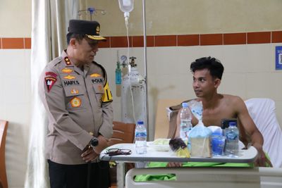 Polda Kaltara Tanggung Biaya Pengobatan Mahasiswa Korban Luka Bakar