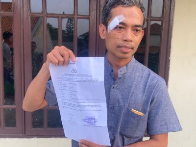 Oknum Petugas Keamanan proyek pengurukan GITET Di Kab.Serang Arogan Pukul Pengendara Motor Yang Melintas Saat Terjadi Macet