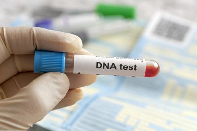 Detektif Jubun Angkat Bicara Soal Tes DNA Sebagai Pembuktian Dalam Kasus Persetubuhan
