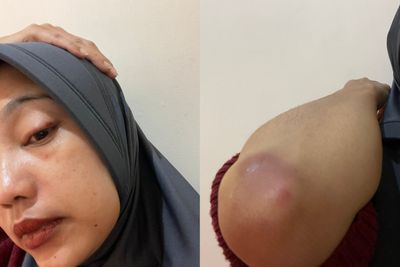 Oknum Kades di Bantaeng Aniaya Istri usai Dituduh Selingkuh dengan Mahasiswi KKN