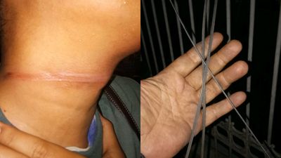 Warga Kota Malang Jadi Korban Jerat Kabel Semrawut Saat Melintas di Jalan