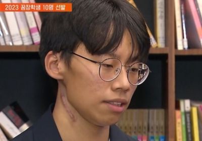 Dari Radioterapi ke Ruang Kuliah: Kisah Ihyunwoo Masuk Seoul National University dengan Kanker Ganas