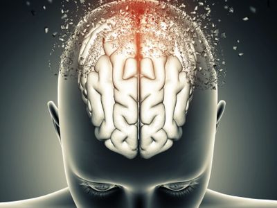 3 Kebiasaan Sepele yang Diam-diam Bisa Merusak Otak, Apa Saja?