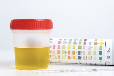 Studi Ungkap Tes Urine Bisa Mendeteksi Kanker Prostat