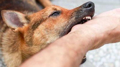 Louis Pasteur, Ilmuwan Pemberani Pertama yang Suntik Vaksin Rabies ke Manusia