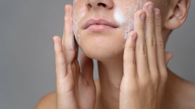 Tips Perawatan Kulit Berminyak agar Tetap Segar
