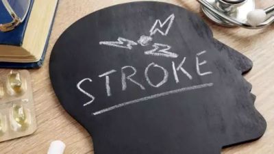 Mencegah Stroke: Pola Hidup Sehat Sebagai Kunci Utama